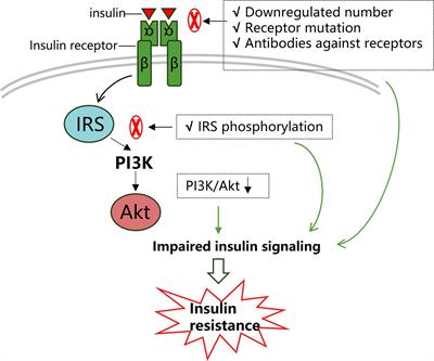 Insulin resistance in the retina: possible implications for certain ocular diseases